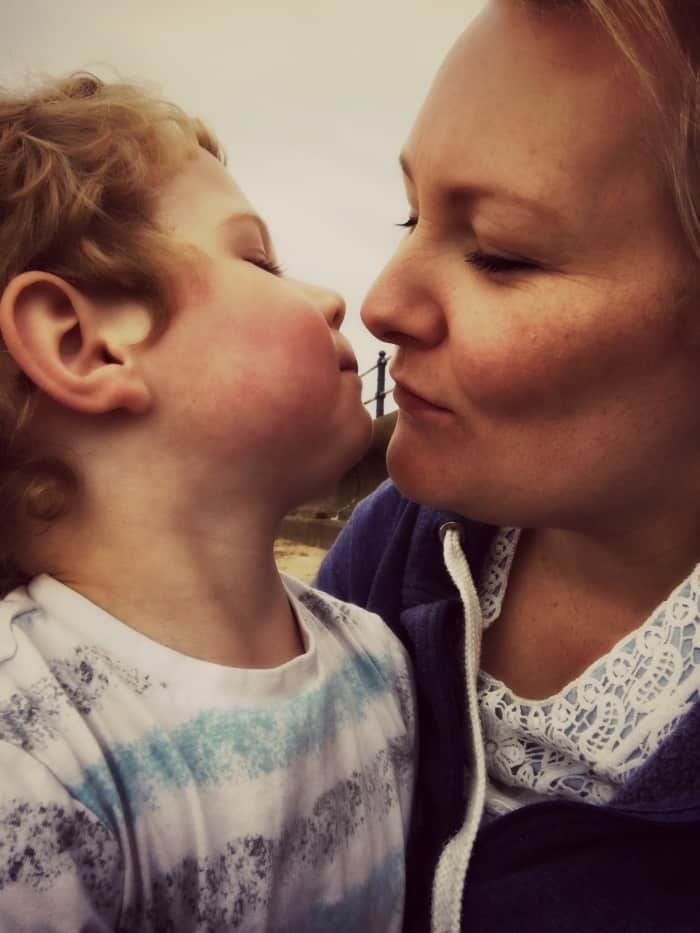 Kisses