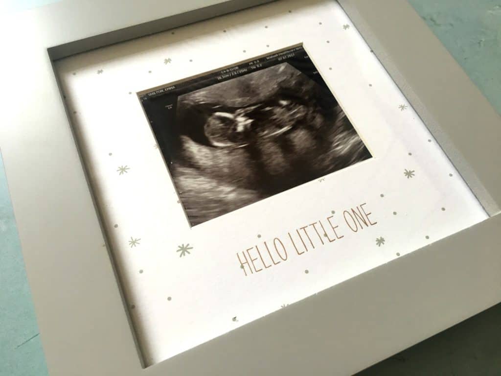 Pregnancy Scan 13w