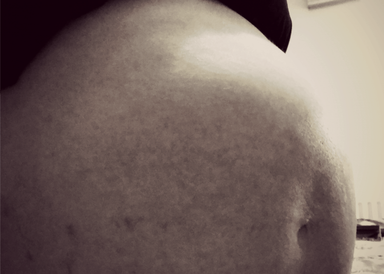 39 weeks pregnant pre-op Caesarean section