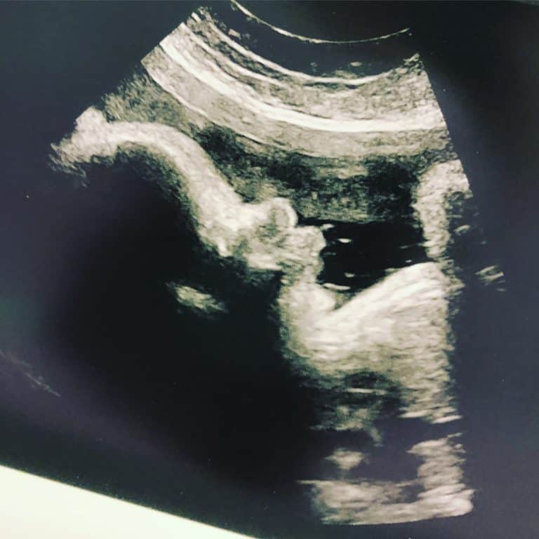 38 weeks baby boy 2018