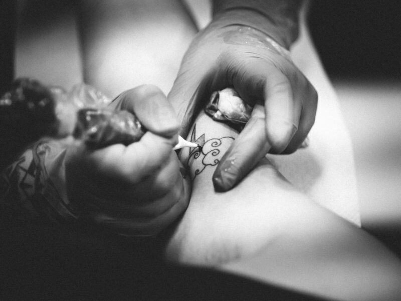 Affordable Tattoo Removal Options You Might Not Know About